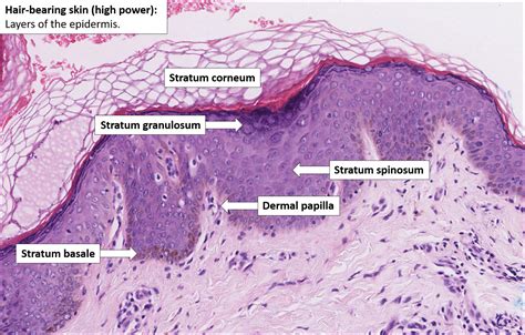 Skin Normal Histology Nus Pathweb Nus Pathweb