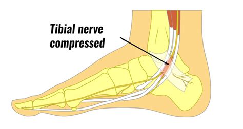 Diagram Diagram Tibial Nerve Foot Mydiagramonline