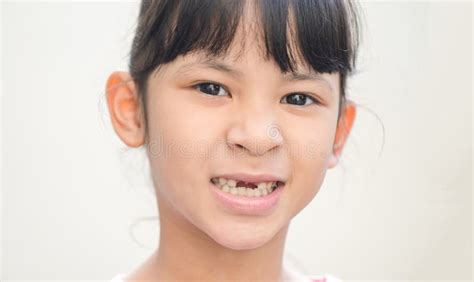 Lost Milk Teeth Lost Baby Tooth Smile Face Of A Child Girl Baby