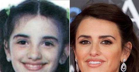 Penelope Cruz Plastic Surgery Before And After Photos Hot Sex Picture