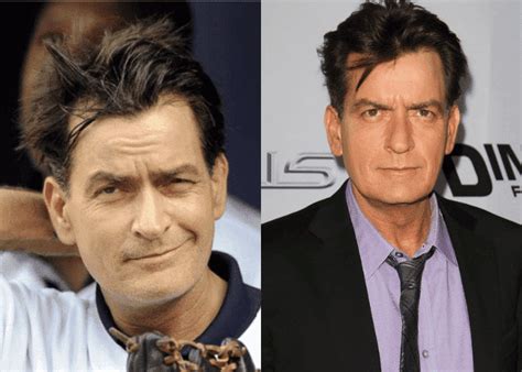 Male Celebrities Wearing Toupees Due To Hair Loss Newtimeshair