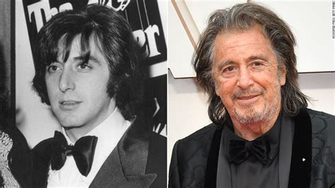 Celebrity Al Pacino Before And After Celeb Surgery Com My XXX Hot Girl