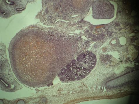 Pathology Outlines Anatomy And Histology Adrenal Medulla And Paraganglia