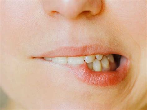 A guide to utilization of the microbiology laboratory for diagnosis of infectious diseases: Cold Sore Symptoms Swollen Lip | Sitelip.org