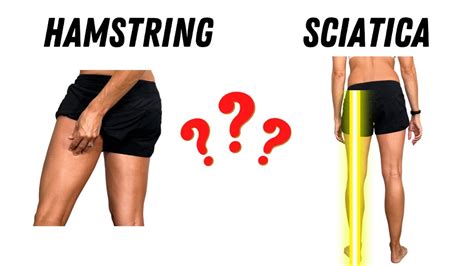 Hamstring Tightness Vs Sciatica Youtube