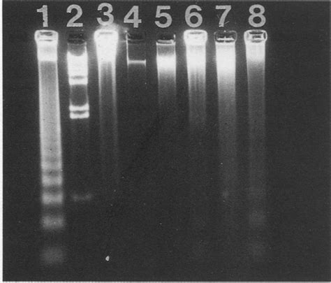 Electrophoresis Dna Ladder