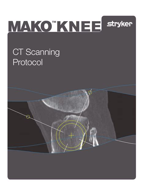 200004 Mako Knee Ct Scanning Protocol