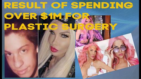 Botched Plastic Surgery The Transgender Who Spent Over 1m In Plastic Surgery Youtube