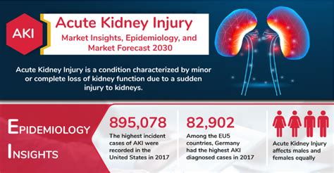 Infographic Acute Kidney Injury Aki Market Insights