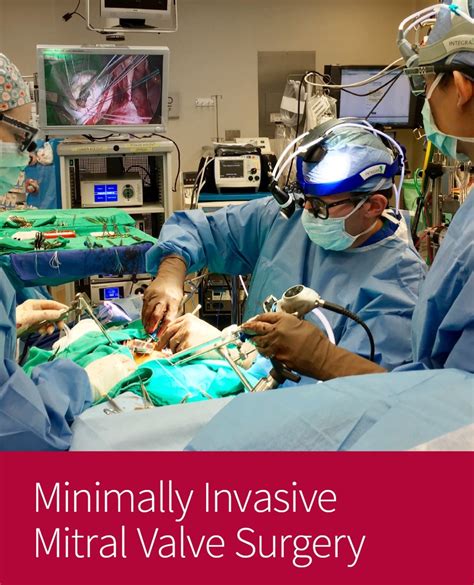 Mitral Valve Repair Surgery Stanford Health Care