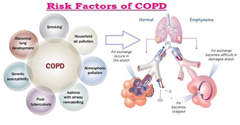 Chronic Obstructive Pulmonary Disease Copd Medicoinfo