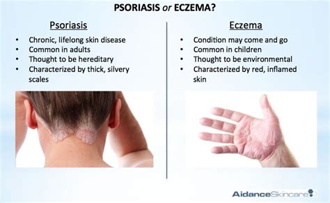 Psoriasis Or Eczema Well Help You Understand The Difference