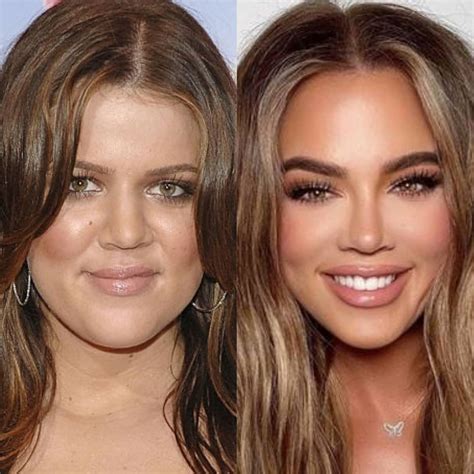 Khloe kardashian before and after photos. Khloe Kardashian hits back at trolls who accused her of ...
