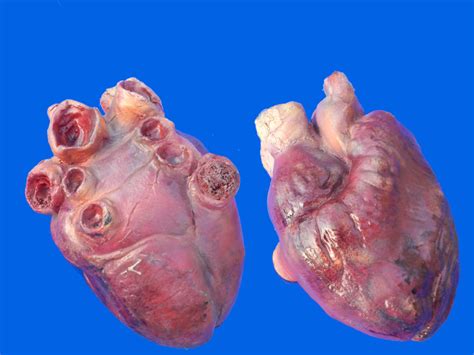 The heart is an amazing organ. Body Parts | Alex in Wonderland