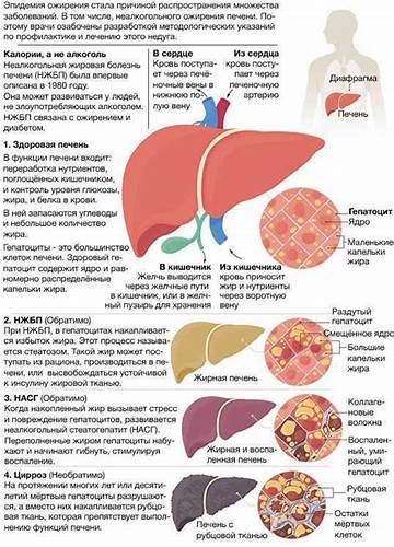Диета и лечение при гепатозе Жирная печень: симптомы, причины, лечение, диета Жирная печень: симптомы, причины, лечение, диета Диета и лечение при гепатозе