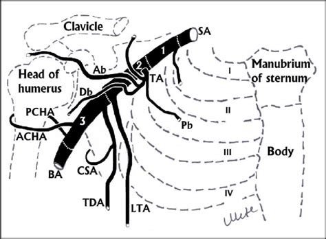 The Subclavian Artery And Its Branches Have Been Demonstrated Sa