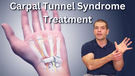 Carpal Tunnel Syndrome Treatment Avoid Carpal Tunnel Surgery