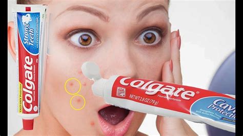 Apply Colgate Toothpaste On Your Skin And See The Magic Toothpaste Beauty Benefit Colgate