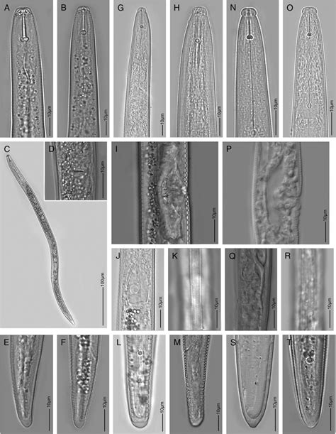 Light Microscopy Images Of Three Plant Parasitic Nematode Species
