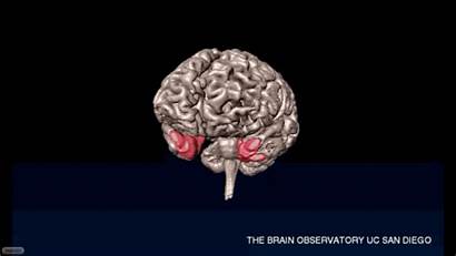 Brain Neuroscience Famous 3d Postmortem Hm History