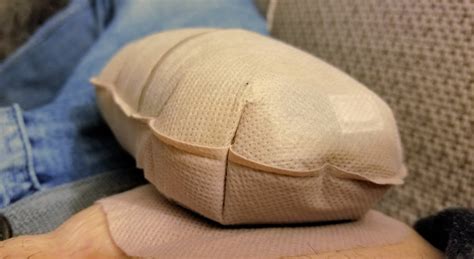 Generally known, a colostomy bag is a pouch needed to connect to and carry through the cut opening stoma after any ostomy surgeries. How To Prevent Embarrassment From Colostomy Gas - Crohns ...