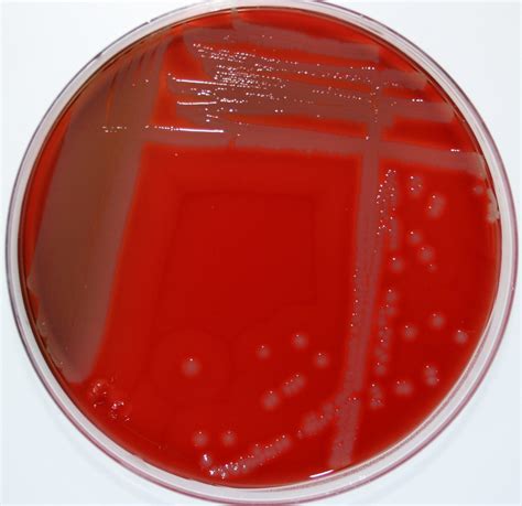 Staphylococcus Pseudintermedius On Blood Agar Staphylococc Flickr