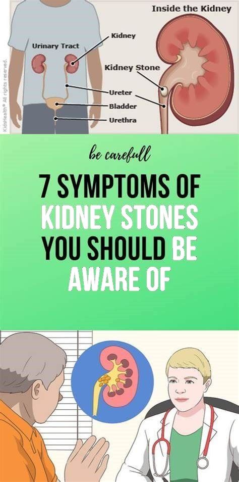 7 Symptoms Of Kidney Stones You Should Be Aware Of Wellness Magazine