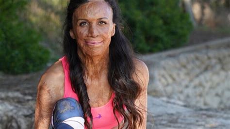 Turia Pitt On Why Mums Shouldn T Be Afraid Of Running After Having A Baby