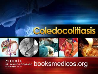 Coledocolitiasis Booksmedicos