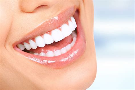 Sbiancamento Dentale Come Funziona E Quanto Costa