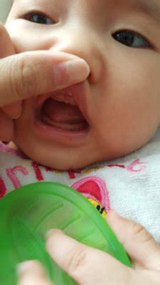 As your child comes through the birth canal during delivery, they'll pick up usage of medications containing steroids. Is this thrush? - March 2016 - BabyCenter Canada