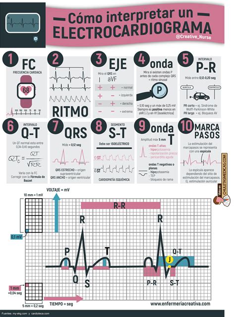 sencillos pasos para interpretar un Electrocardiograma Chuletas Médicas