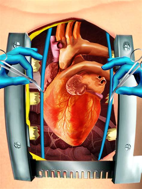 Open Heart Surgery Simulator For Android Apk Download