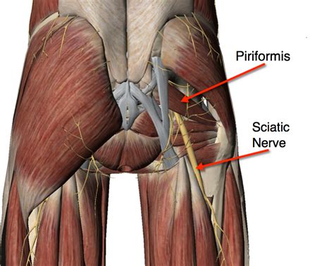 Most people talk about sciatica when they discuss pain radiating into the leg. Triple Threat Triathlon: TTT Mysteries: Nervous Breakdown ...