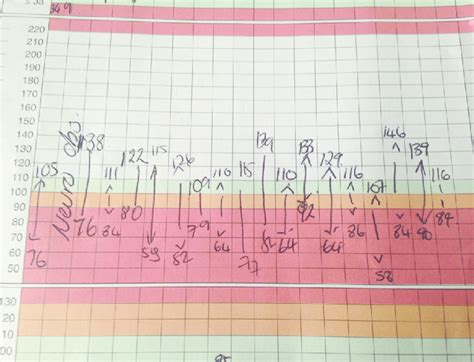 Observation Chart Showing Fluctuations In Blood Pressure Avinash