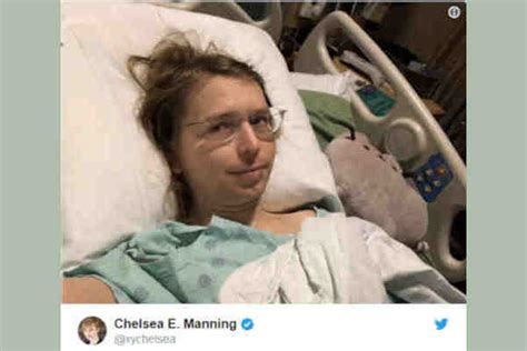 Chelsea Manning Posts Photo After Gender Reassignment Surgery On Top