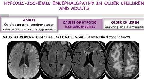 Figure 10 From Hypoxic Ischemic Encephalopathy Review Mechanisms Of