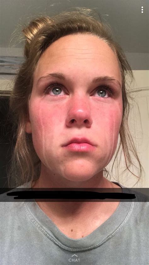 Why You Should Not Cry After A Spray Tan