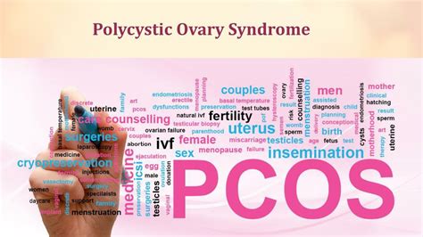 ppt polycystic ovary syndrome pcos powerpoint presentation free download id 7573568