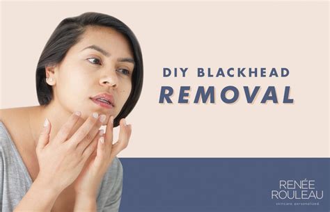 How To Manually Extract Blackheads And Clogged Pores From Your Skin