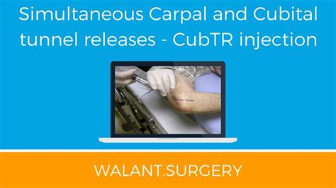 Cubital Tunnel Release Using Walant Youtube