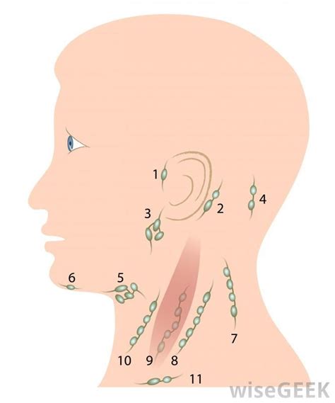 Symptoms of secondary cancer in the lymph nodes the most common symptom of cancer in the lymph nodes is that 1 or more lymph nodes become swollen or feel hard. Lymph nodes usually become swollen due to infection or ...