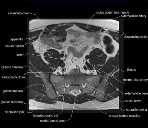 Included within the chart are gorgeous illustrations of the pelvic diaphragm, sphincter muscles, gluteus maximus. MRI pelvis anatomy | free male pelvis axial anatomy
