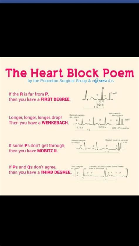 Easy Way To Remember Heart Blocks Nursing Mnemonics Nursing School
