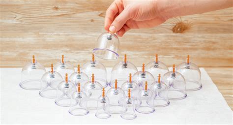Experience The Healing Power Of Hijama Cupping Therapy For Better Health General Health