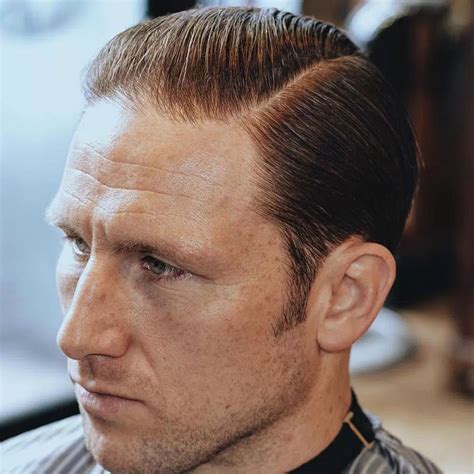 Https://tommynaija.com/hairstyle/best Hairstyle For Side Bald
