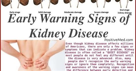Kidney Failure Signs Symptoms And Treatment Kwara Reporters