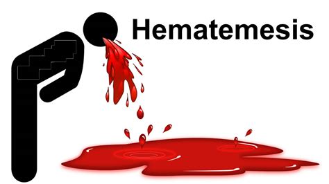 Hematemesis Vomiting Blood Causes And Treatment