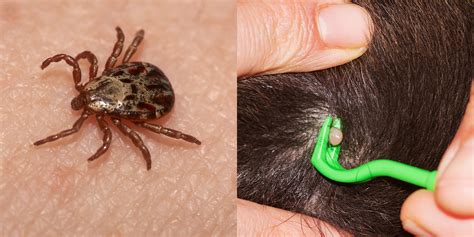 Tick Identification And Removal Tips Self