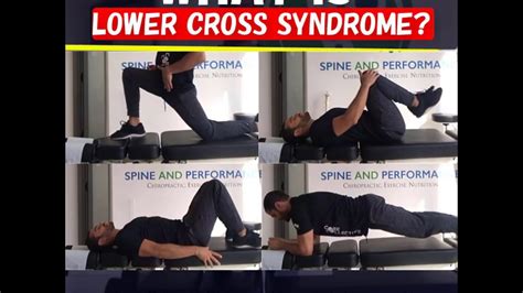 Lower Cross Syndrome Exercises Captions Save